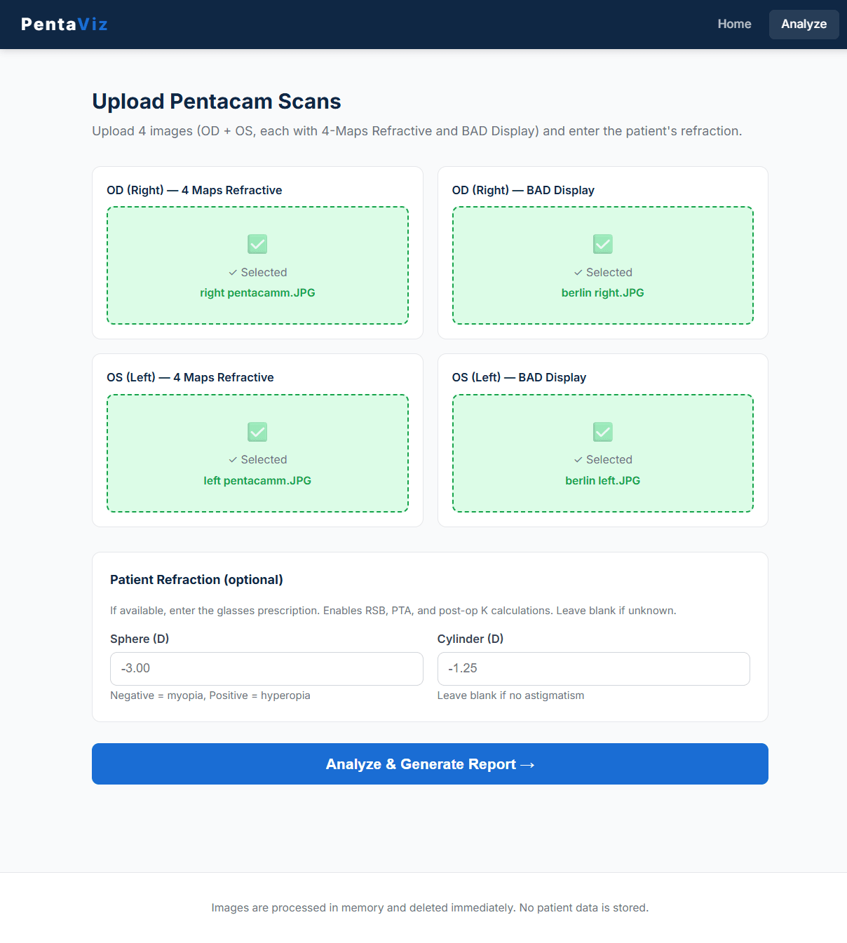 Kera AI upload interface showing four Pentacam image slots